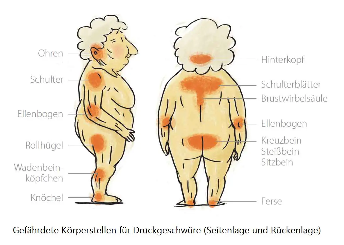 Ambulante Pflege Gute Professionelle Pflege Erkennen Stiftung Zqp